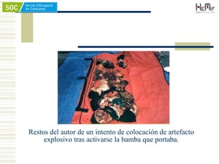 Restos del autor de un intento de colocación de artefacto
explosivo tras activarse la bamba que portaba.
 
