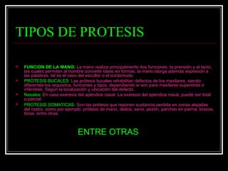 TIPOS DE PROTESIS <ul><li>FUNCION DE LA MANO:   La mano realiza principalmente dos funciones; la prensión y el tacto, las ...