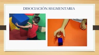 DISOCIACIÓN SEGMENTARIA
 