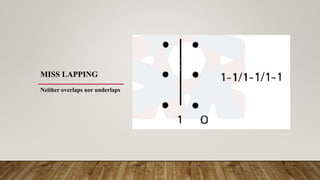 MISS LAPPING
Neither overlaps nor underlaps
 