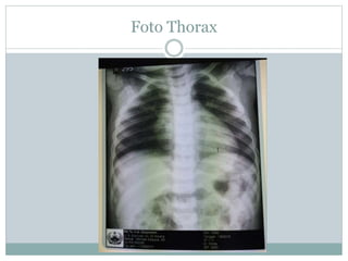 Foto Thorax
 