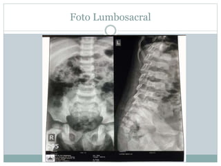 Foto Lumbosacral
 