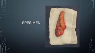 SPESIMEN
 