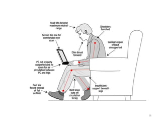 16
Bad Laptop Postures
 