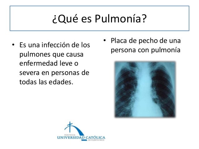 Por que modo de aumentar lo mejor de todo el pecho