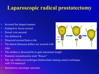 Laparoscopic radical prostatectomy
• Inverted fan shaped manner
• Endopelvic fascia incised
• Dorsal vein secured
• Vas deferens &
• Dissected secured hem-o-lok
• The lateral detrussor pillars are secured with
clips
• The urethra is dissected be to gain maximum length
• Posterior reconstruction stich “Rocco”
• The van velthowen technique (bidirectinal running suture) technique
with 3-0 monocryl
• Satisfactory oncologic outcome
 