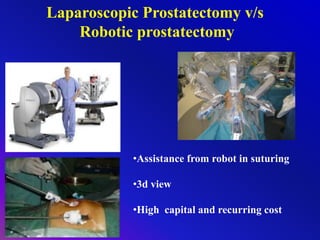 Laparoscopic Prostatectomy v/s
Robotic prostatectomy
•Assistance from robot in suturing
•3d view
•High capital and recurring cost
 