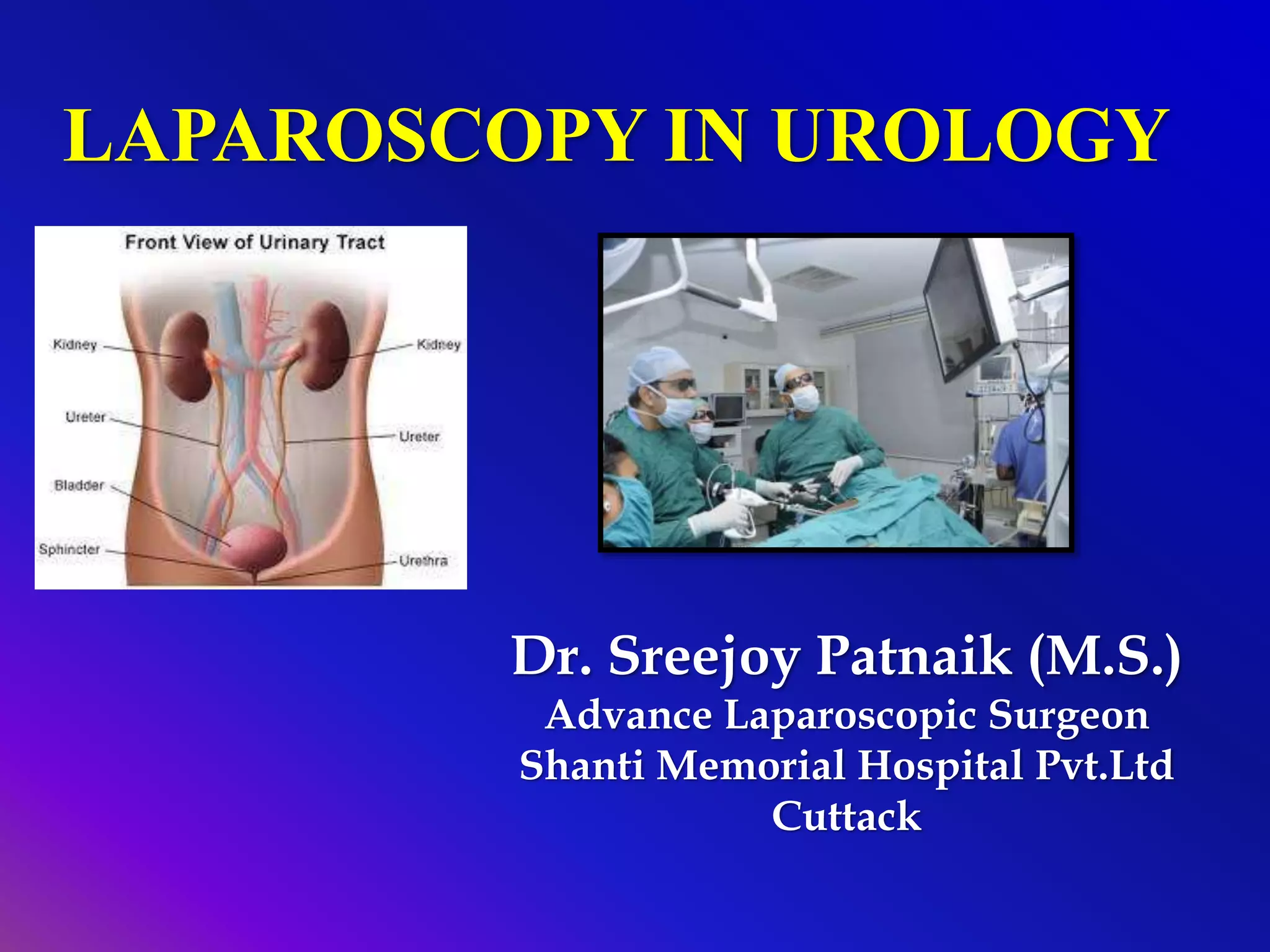 LAPAROSCOPIC UROLOGY PPT. DR SREEJOY PATNAIK PPT