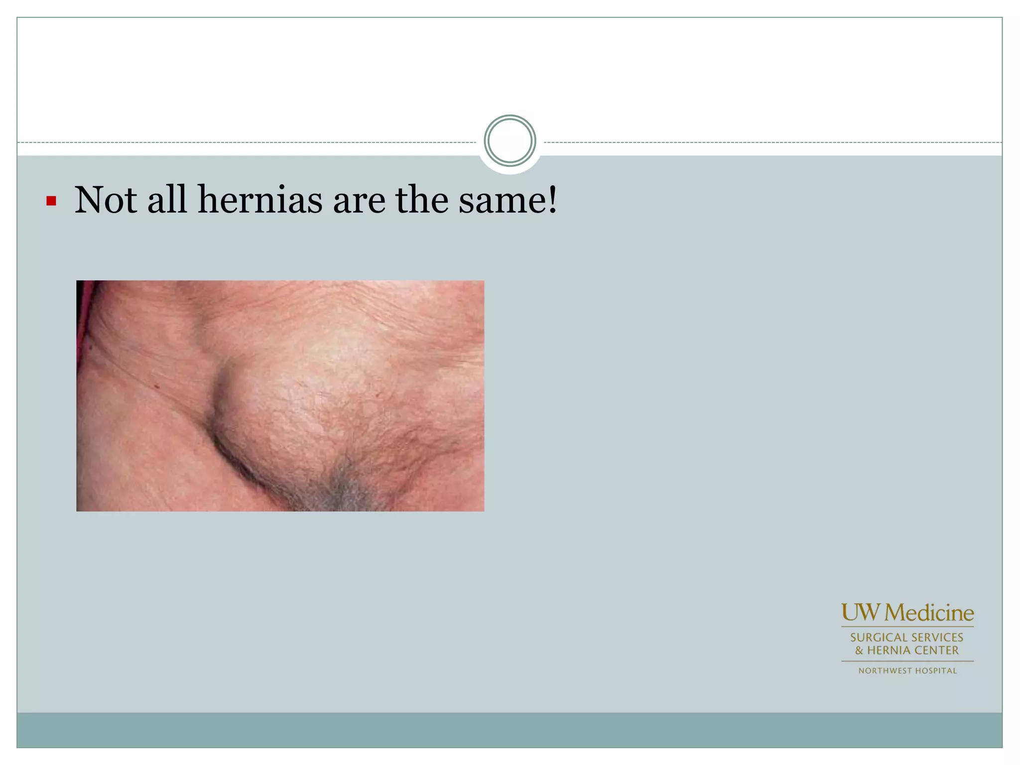  Not all hernias are the same!
 