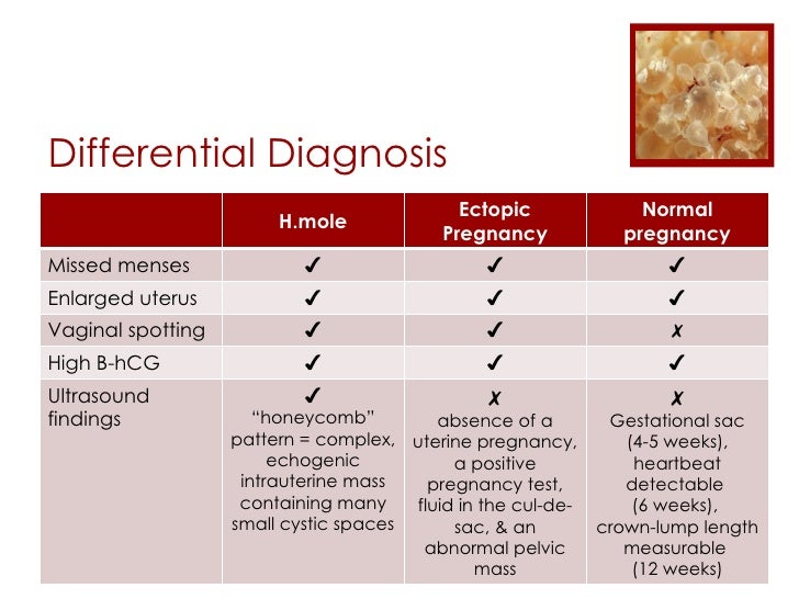 test pregnancy positive h-mole Pregnancy Molar