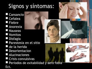 Signos y síntomas:
 Cansancio
 Cefalea
 Fiebre
 Anorexia
 Nauseas
 Vomitos
 Disfagia
 Parestesia en el sitio
 de la herida
 Desorientacion
 Alucinaciones
 Crisis convulsivas
 Periodos de exitabilidad y aero fobia
Ect.
 