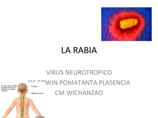 LA RABIA VIRUS NEUROTROPICO QF EDWIN POMATANTA PLASENCIA CM WICHANZAO 