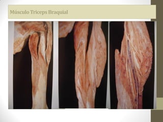 MúsculoTricepsBraquial
 