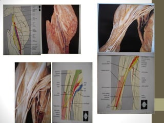 La región del brazo
