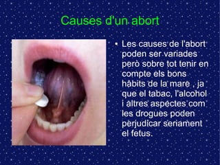Causes d'un abort 
● Les causes de l'abort 
poden ser variades 
però sobre tot tenir en 
compte els bons 
hàbits de la mare , ja 
que el tabac, l'alcohol 
i altres aspectes com 
les drogues poden 
perjudicar seriament 
el fetus. 
 