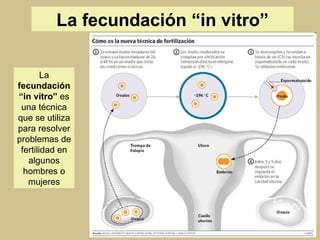 La  fecundación “in vitro”  es una técnica que se utiliza para resolver problemas de fertilidad en algunos hombres o mujeres La fecundación “in vitro” 