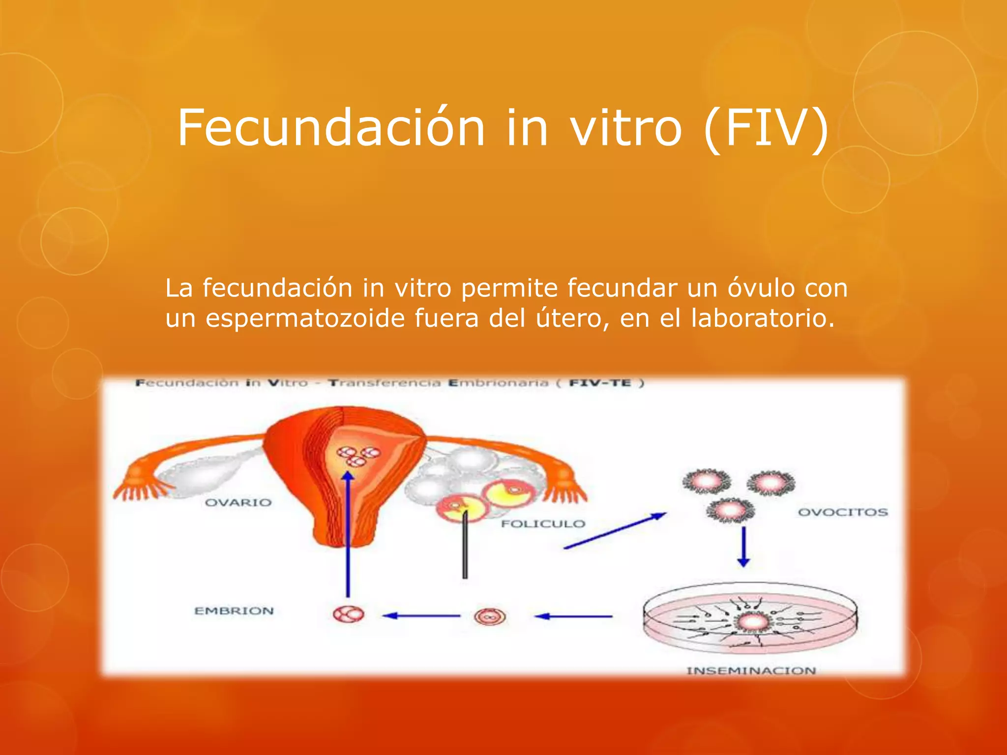 Fecundación in vitro (FIV)
La fecundación in vitro permite fecundar un óvulo con
un espermatozoide fuera del útero, en el laboratorio.

 
