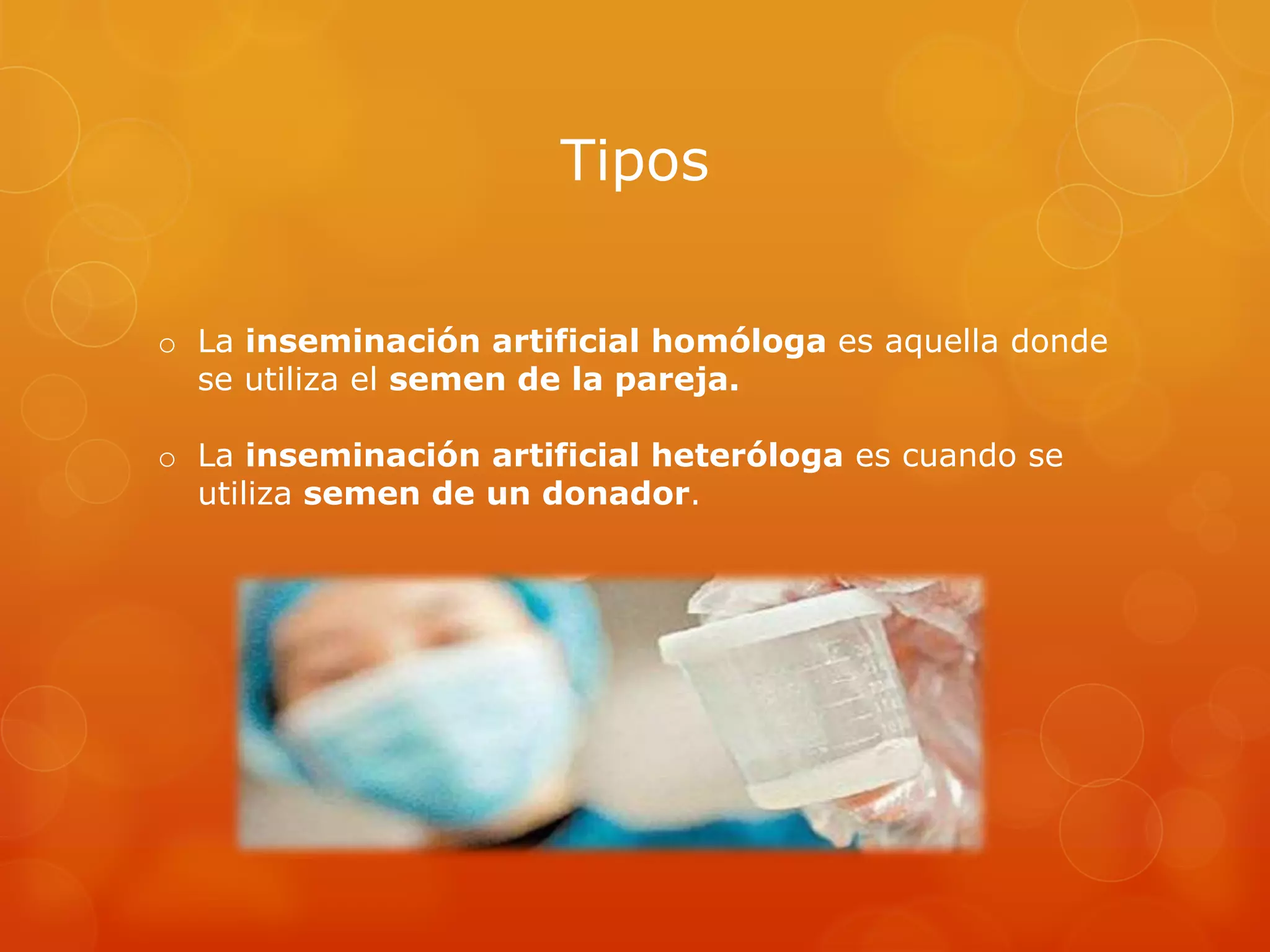 Tipos
o La inseminación artificial homóloga es aquella donde
se utiliza el semen de la pareja.
o La inseminación artificial heteróloga es cuando se
utiliza semen de un donador.

 