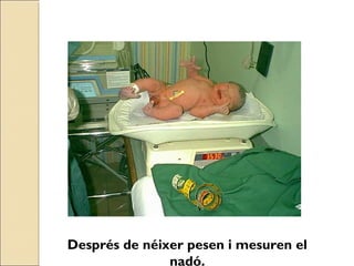 Després de néixer pesen i mesuren el
nadó.
 