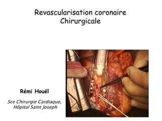 Revascularisation coronaire
Chirurgicale
Rémi Houël
Sce Chirurgie Cardiaque,
Hôpital Saint Joseph
 