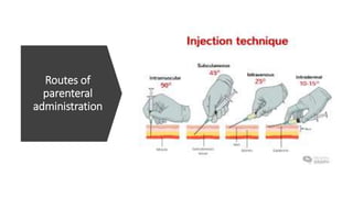Routes of
parenteral
administration
 