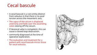Large Bowel Obstruction- Evaluation and Management .pptx
