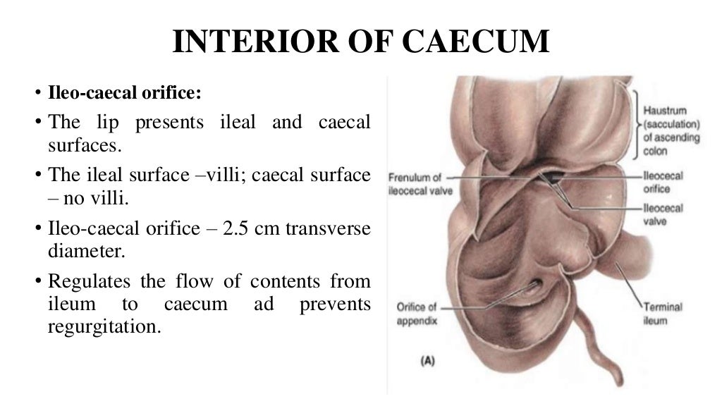 Large intestine , Caecum and Appendix.pptx