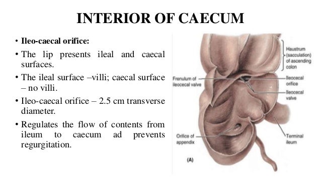 Large intestine , Caecum and Appendix.pptx | Digestive Disorders ...