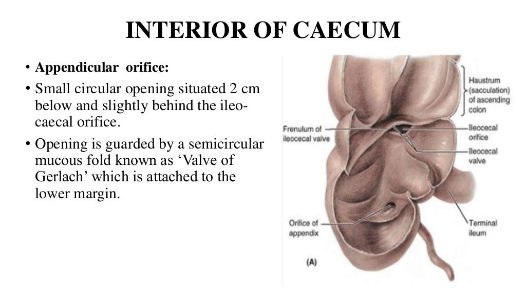 Large intestine , Caecum and Appendix.pptx