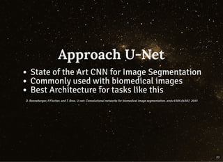 Approach U-NetApproach U-Net
State of the Art CNN for Image Segmentation
Commonly used with biomedical images
Best Architecture for tasks like this
O. Ronneberger, P.Fischer, and T. Brox. U-net: Convolutional networks for biomedical image segmentation. arxiv:1505.04597, 2015O. Ronneberger, P.Fischer, and T. Brox. U-net: Convolutional networks for biomedical image segmentation. arxiv:1505.04597, 2015
20
 