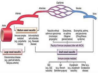 Vas Rheumatology large vessel vasculitis.rheumatology ppt | PPTX