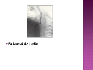 Rx lateral de cuello 