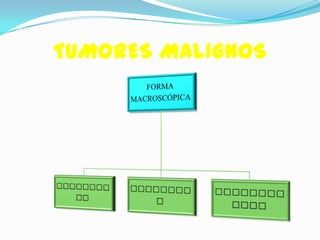 TUMORES MALIGNOS
 