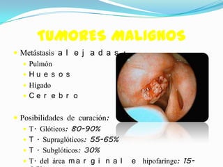 TUMORES MALIGNOS
 Metástasis a l e j a d a s :
   Pulmón
   Hu e s o s
   Hígado
  Ce r e b r o


 Posibilidades de curación:
    T. Glóticos: 80-90%
    T . Supraglóticos: 55-65%
    T . Subglóticos: 30%
    T. del área m a r g i n a l   e hipofarínge: 15-
 