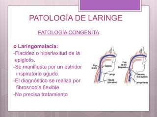 PATOLOGÍA DE LARINGE
PATOLOGÍA CONGÉNITA
 Laringomalacia:
-Flacidez o hiperlaxitud de la
epiglotis.
-Se manifiesta por un estridor
inspiratorio agudo
-El diagnóstico se realiza por
fibroscopia flexible
-No precisa tratamiento
 