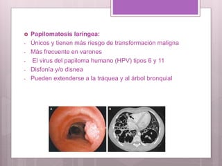  Papilomatosis laríngea:
- Únicos y tienen más riesgo de transformación maligna
- Más frecuente en varones
- El virus del papiloma humano (HPV) tipos 6 y 11
- Disfonía y/o disnea
- Pueden extenderse a la tráquea y al árbol bronquial
 