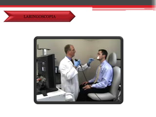 LARINGOSCOPIA