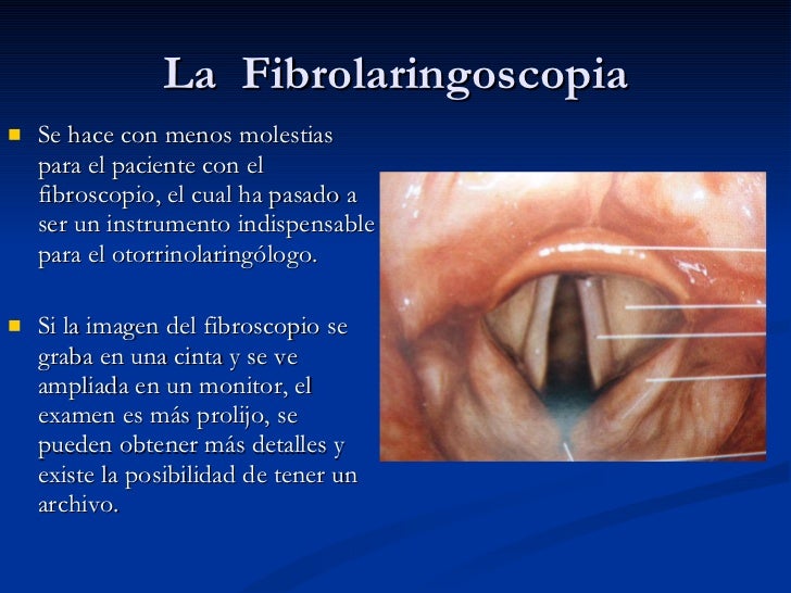 Differenza Tra Laringoscopia E Fibrolaringoscopia Laringe, generalidades y tumores 2011