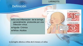 LARINGITIS
Definición
 Es una inflamación de la laringe,
generalmente producida por una
infección vírica.
 Aguda- Crónica
 Niños- Adultos
la laringitis afecta a niños de 6 meses a 3 años
 
