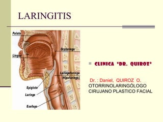 LARINGITIS



              CLINICA “Dr. QUIROZ”



             Dr. : Daniel, QUIROZ O.
             OTORRINOLARINGÓLOGO
             CIRUJANO PLASTICO FACIAL
 