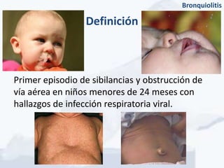 Bronquiolitis

                 Definición



Primer episodio de sibilancias y obstrucción de
vía aérea en niños menores de 24 meses con
hallazgos de infección respiratoria viral.
 