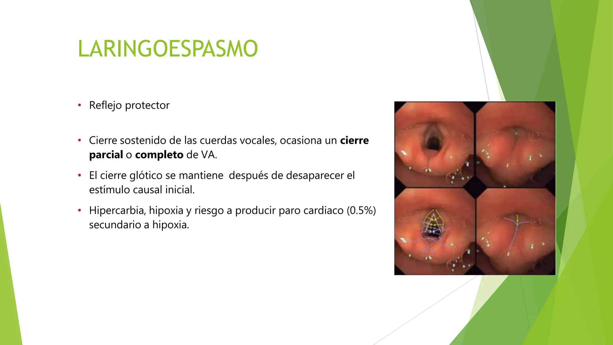 manejo de laringoespasmo en el perioperatorio | PPTX