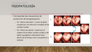 FISIOPATOLOGÍA
n
• Fink describe dos mecanismos de
producción de laringoespasmo:
• Por “efecto obturador” o cierre de glotis
causado por una aducción completa de las
cuerdas vocales.
• Por “efecto de válvula”, creado por el
colapso de las falsas cuerdas vocales y del
tejido supraglótico redundante hacia
dentro de la laringe, como una pelota en u
embudo
Revista EMIVA News 2020;20(4)
 