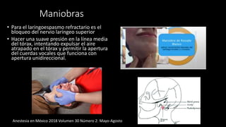 Maniobras
• Para el laringoespasmo refractario es el
bloqueo del nervio laríngeo superior
• Hacer una suave presión en la línea media
del tórax, intentando expulsar el aire
atrapado en el tórax y permitir la apertura
del cuerdas vocales que funciona con
apertura unidireccional.
Anestesia en México 2018 Volumen 30 Número 2: Mayo-Agosto
 