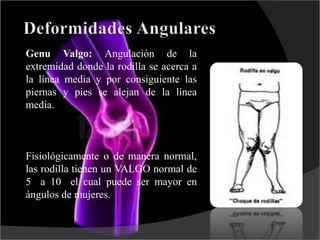 Genu Valgo: Angulación de la
extremidad donde la rodilla se acerca a
la línea media y por consiguiente las
piernas y pies se alejan de la línea
media.
Fisiológicamente o de manera normal,
las rodilla tienen un VALGO normal de
5 a 10 el cual puede ser mayor en
ángulos de mujeres.
 