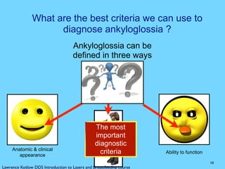What are the best criteria we can use to
diagnose ankyloglossia ?
16
Ankyloglossia can be
defined in three ways
Anatomic & clinical
appearance
Ability to function
Infant’s &
mother’s
symptoms
Lawrence Kotlow DDS Introduction to Lasers and Breastfeeding course
The most
important
diagnostic
criteria
 