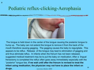 Pediatric reflux-clicking-Aerophasia
30
The tongue is held down in the center of the tongue causing the posterior tongue to
hump up. The baby can not extend the tongue to remove it from the back of the
mouth therefore causing gagging. The gagging causes the baby to regurgitate. This
appears to be reflux. Release of the tongue may lead to elimination of gagging and
and thus eliminate reflux. In infants when the frenum has not been released,
suggested medical treatment may be to put the baby on medication. After a lingual
frenectomy is completed the reflux often goes away immediately especially with the
“posterior” tongue ties. if we wait until after the frenum is revised to treat the
infant using medication, the physician may not have to place the infant on
drugs.
a
Lawrence Kotlow DDS
 