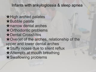 Infants with ankyloglossia & sleep apnea
★High arched palates
★Bubble palate
★narrow dental arches
★Orthodontic problems
★Dental Crossbites
★Overjet of the arches, relationship of the
upper and lower dental arches
★Stuffy noses due to silent reflux
★Attempts at mouth breathing
★Swallowing problems
 