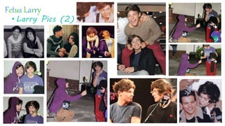 Fetus Larry
•Larry Pics (2)
 