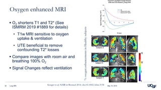Lung MRI | PDF